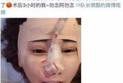 整形手术爆料视频大全最新,最新爆料视频大全深度解析
